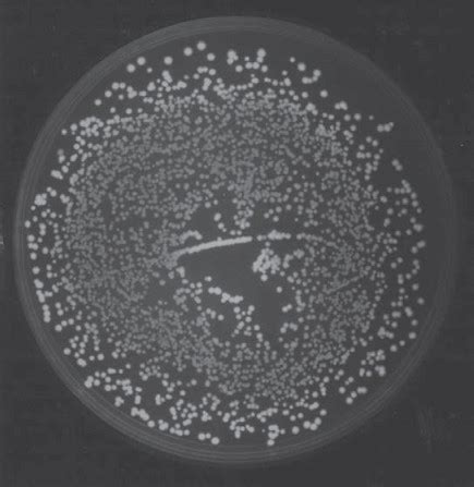 Use of cobA and cysGA as Red Fluorescent Indicators.